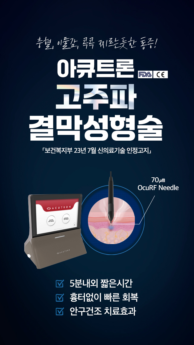 고주파 결막성형술